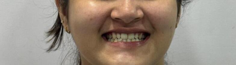 After